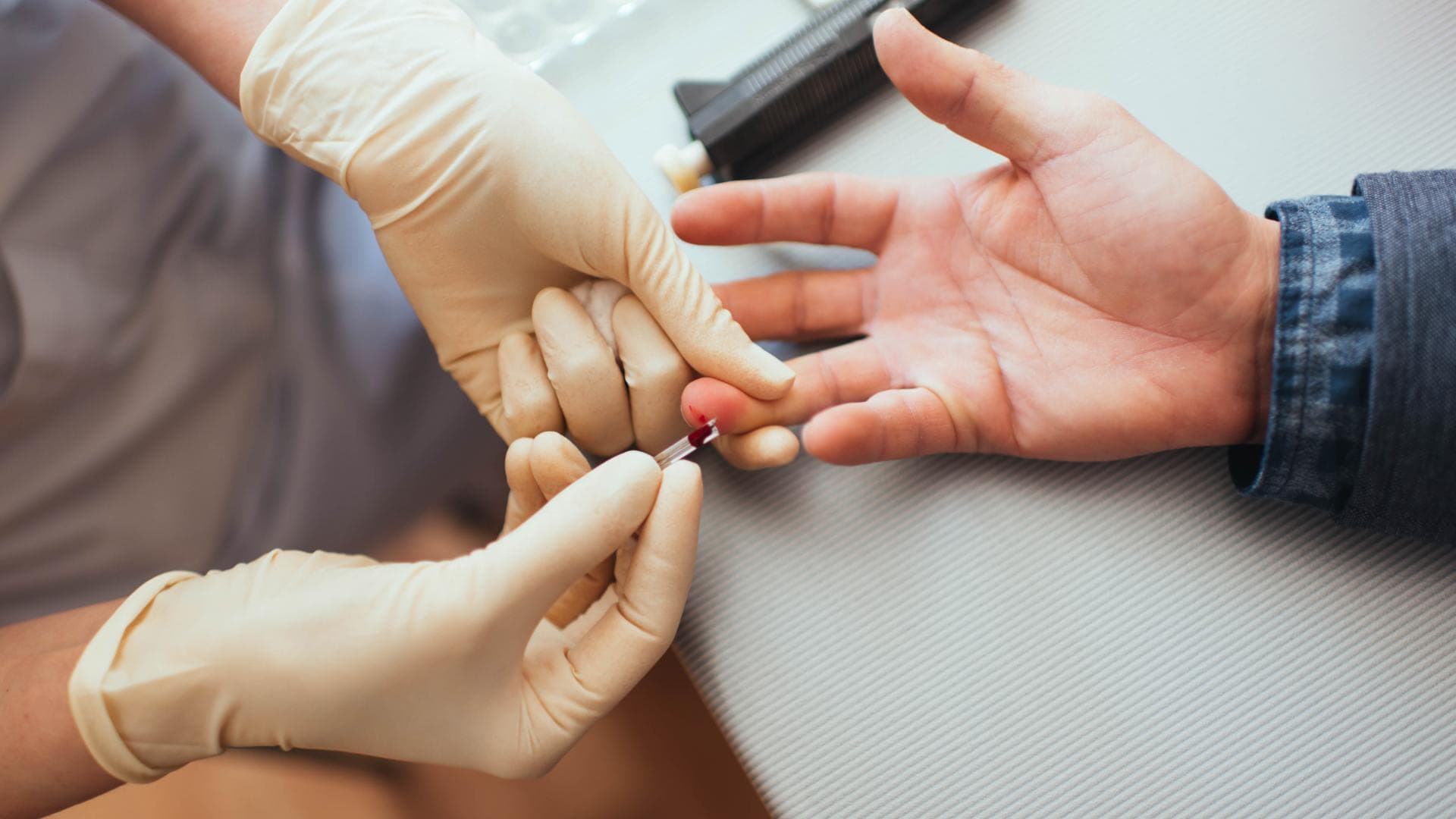 HIV aids test blutzucker