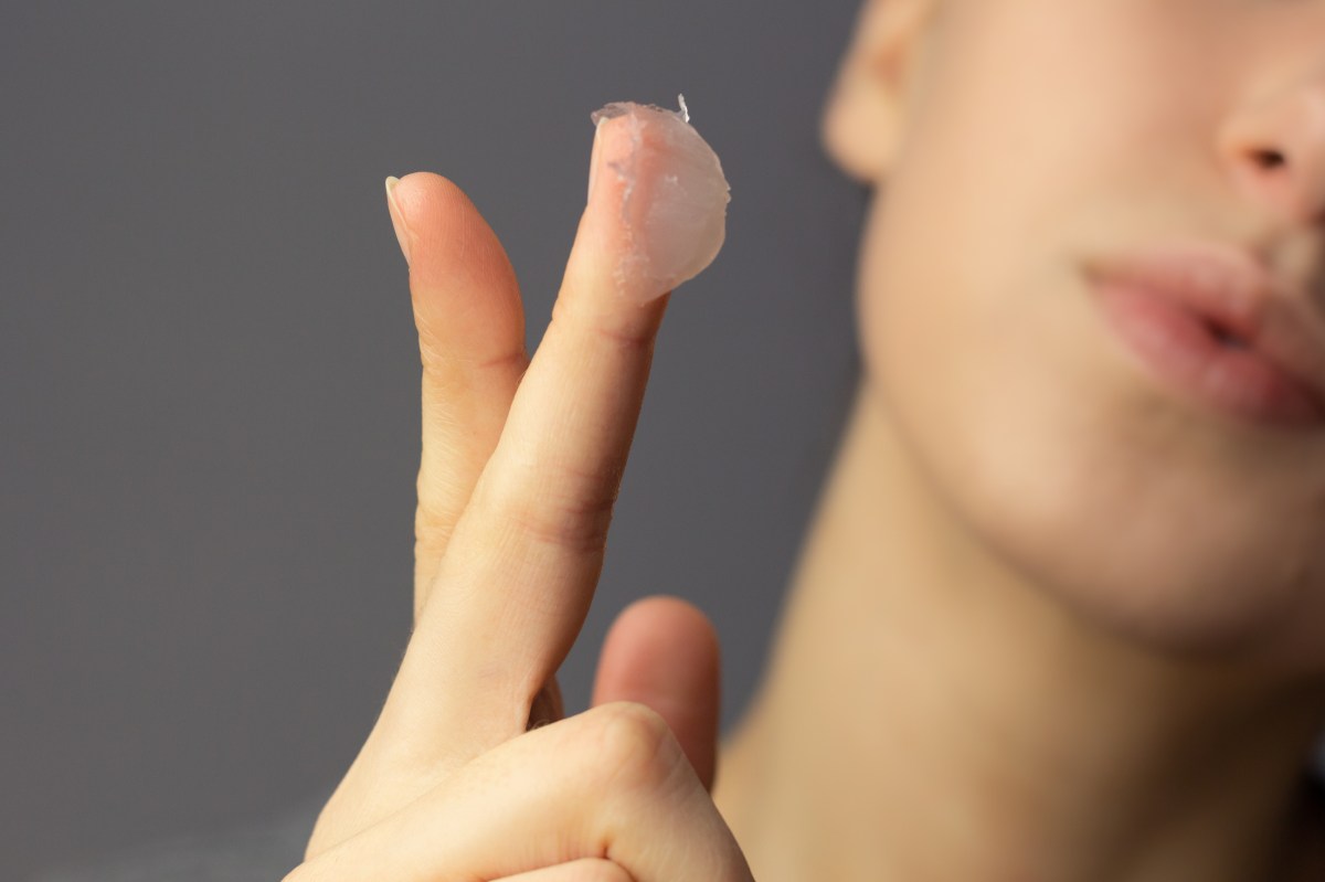 Hand Slugging: Vaseline für rissig Hände